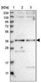 Anti-SNX16 antibody produced in rabbit Prestige Antibodies® Powered by Atlas Antibodies, affinity isolated antibody, buffered aqueous glycerol solution, ab1
