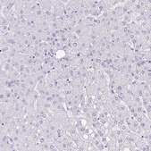Anti-EPYC antibody produced in rabbit Prestige Antibodies® Powered by Atlas Antibodies, affinity isolated antibody, buffered aqueous glycerol solution