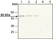 Anti-Doublecortin (N-terminal) antibody produced in rabbit ~1.5 mg/mL, affinity isolated antibody, buffered aqueous solution