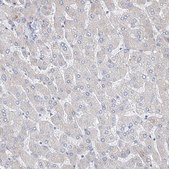 Anti-REC8 antibody produced in rabbit Prestige Antibodies® Powered by Atlas Antibodies, affinity isolated antibody, buffered aqueous glycerol solution