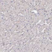 Anti-GUCY2C antibody produced in rabbit Prestige Antibodies® Powered by Atlas Antibodies, affinity isolated antibody, buffered aqueous glycerol solution