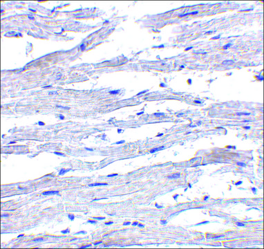 Anti-RIG-1 antibody produced in rabbit affinity isolated antibody, buffered aqueous solution