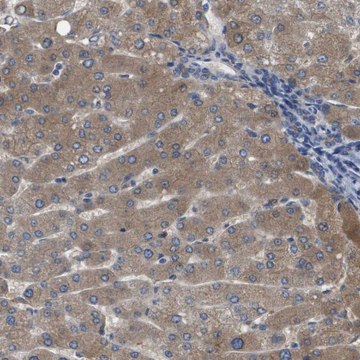 Anti-SERPINA6 antibody produced in rabbit Prestige Antibodies&#174; Powered by Atlas Antibodies, affinity isolated antibody, buffered aqueous glycerol solution