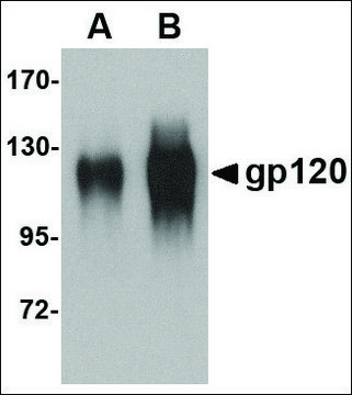 Anti-gp120 antibody produced in goat affinity isolated antibody, buffered aqueous solution