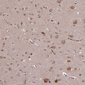 Anti-SLC38A7 antibody produced in rabbit Prestige Antibodies® Powered by Atlas Antibodies, affinity isolated antibody, buffered aqueous glycerol solution