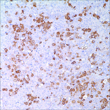 Mammaglobin (31A5) Rabbit Monoclonal Antibody