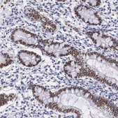 Anti-HMGN5 antibody produced in rabbit Prestige Antibodies® Powered by Atlas Antibodies, affinity isolated antibody, buffered aqueous glycerol solution