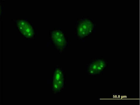 Anti-DDX24 antibody produced in mouse purified immunoglobulin, buffered aqueous solution