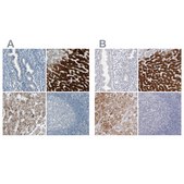 Anti-CYP2E1 antibody produced in rabbit Prestige Antibodies® Powered by Atlas Antibodies, affinity isolated antibody, buffered aqueous glycerol solution