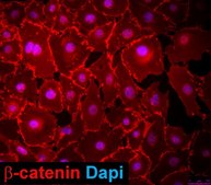 MEC1 Mouse Embryonic Epicardial Cell Line MEC1 mouse embryonic epicardial cell line is a useful model for cardiac developmental biology studies.