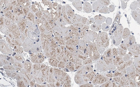 Anti-RHOT1/MIRO-1 Antibody, clone 1F4 ZooMAb&#174; Rabbit Monoclonal recombinant, expressed in HEK 293 cells