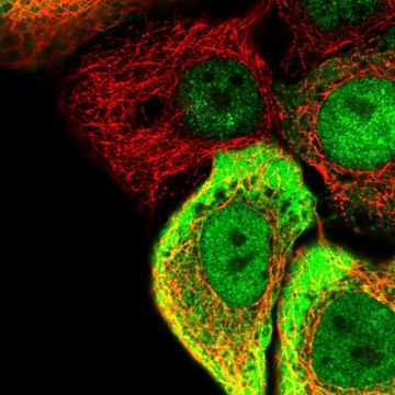 Anti-SC5D antibody produced in rabbit Prestige Antibodies&#174; Powered by Atlas Antibodies, affinity isolated antibody