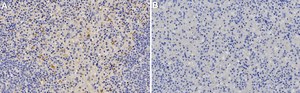 Anti-TIM-3/HAVCR2 Antibody, clone 2B7-L1 ZooMAb® Rabbit Monoclonal recombinant, expressed in HEK 293 cells