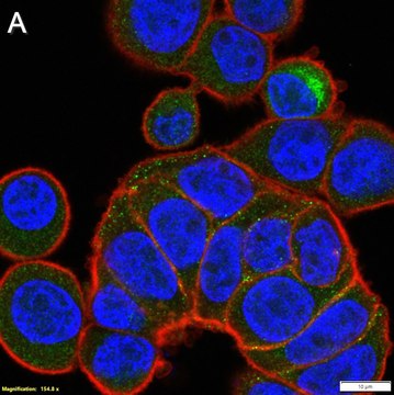 Anti-MMP-7 Antibody, clone 2B3 ZooMAb&#174; Rabbit Monoclonal recombinant, expressed in HEK 293 cells