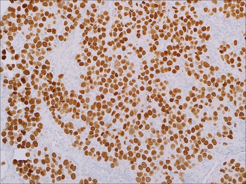 SALL4 (EP299) Rabbit Monoclonal Primary Antibody