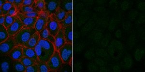Anti-MDM2 Antibody, clone IF2, Alexa Fluor™ 488 Conjugate clone IF2, from mouse, ALEXA FLUOR™ 488