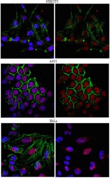 Anti-mRNA-capping enzyme Antibody from rabbit, purified by affinity chromatography