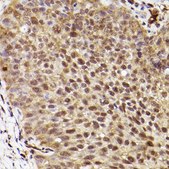 Anti-ERK1 antibody produced in rabbit