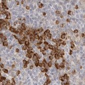 Anti-RPN1 antibody produced in rabbit Prestige Antibodies® Powered by Atlas Antibodies, affinity isolated antibody, buffered aqueous glycerol solution