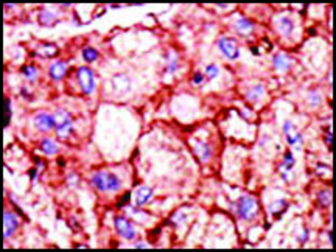 Anti-PFKP (N-term) antibody produced in rabbit IgG fraction of antiserum, buffered aqueous solution