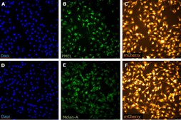 RMS RET Melanoma-sorted Mouse Cell Line