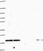 Anti-RHOH antibody produced in rabbit Prestige Antibodies® Powered by Atlas Antibodies, affinity isolated antibody, buffered aqueous glycerol solution