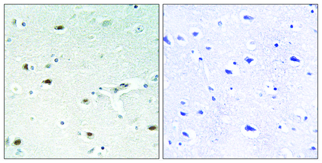 Anti-Retinoblastoma antibody produced in rabbit affinity isolated antibody