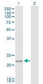 Anti-CTF1 antibody produced in rabbit purified immunoglobulin, buffered aqueous solution