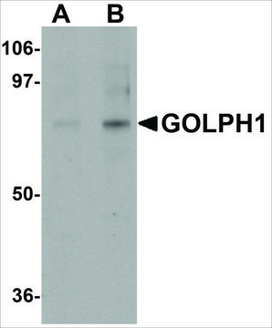 Anti-GOLPH1 antibody produced in rabbit affinity isolated antibody, buffered aqueous solution