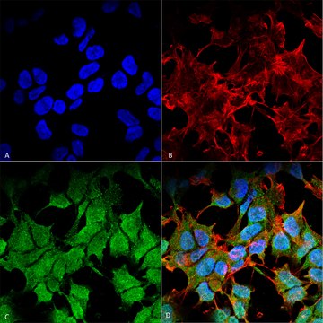 Monoclonal Anti-Kir6.1 antibody produced in mouse clone S366-60