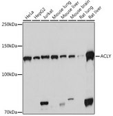 Anti-ACLY Antibody, clone 8A0V0, Rabbit Monoclonal