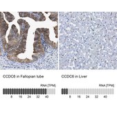 Anti-CCDC6 antibody produced in rabbit Prestige Antibodies® Powered by Atlas Antibodies, affinity isolated antibody, buffered aqueous glycerol solution, Ab2