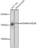 Anti-KDM4B/JMJD2B Antibody, clone 8I0I1, Rabbit Monoclonal