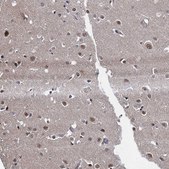 Anti-UBLCP1 antibody produced in rabbit Prestige Antibodies® Powered by Atlas Antibodies, affinity isolated antibody, buffered aqueous glycerol solution