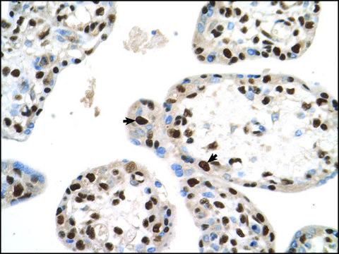 Anti-SETD2 antibody produced in rabbit IgG fraction of antiserum