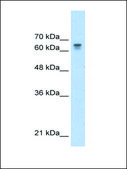 Anti-PARP6 antibody produced in rabbit affinity isolated antibody