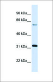 Anti-LGALS3 antibody produced in rabbit affinity isolated antibody