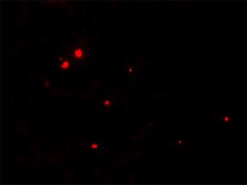 Anti-RNASET2 antibody produced in rabbit affinity isolated antibody