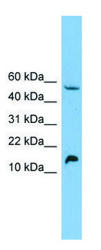 Anti-EPO antibody produced in rabbit affinity isolated antibody