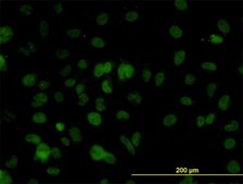 Monoclonal Anti-SMARCD2 antibody produced in mouse clone 2F7, purified immunoglobulin, buffered aqueous solution