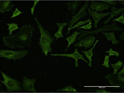 Monoclonal Anti-RPL32 antibody produced in mouse clone 1B11, purified immunoglobulin, buffered aqueous solution