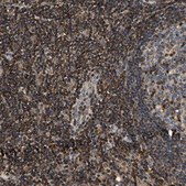 Anti-SAMD9 antibody produced in rabbit Prestige Antibodies® Powered by Atlas Antibodies, affinity isolated antibody, buffered aqueous glycerol solution, Ab1