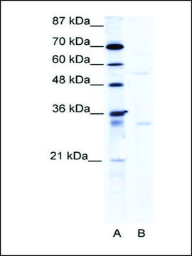 Anti-TRIM17 (AB2) antibody produced in rabbit IgG fraction of antiserum