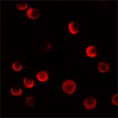 Anti-CASKIN2 antibody produced in rabbit affinity isolated antibody