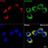 Anti-ENO2 Antibody, clone 9B4Y4, Rabbit Monoclonal