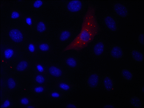 Anti-DCP1A (N-terminal) antibody produced in rabbit ~1.0&#160;mg/mL, affinity isolated antibody, buffered aqueous solution