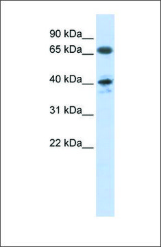 Anti-AGTR1 antibody produced in rabbit affinity isolated antibody