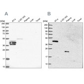 Anti-SPESP1 antibody produced in rabbit Prestige Antibodies® Powered by Atlas Antibodies, affinity isolated antibody, buffered aqueous glycerol solution