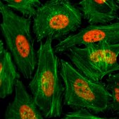 Anti-Monomethyl-Histone H3 (Lys4) antibody, Rabbit monoclonal recombinant, expressed in HEK 293 cells, clone RM140, purified immunoglobulin