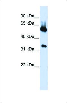 Anti-ALAS2 (ab1) antibody produced in rabbit affinity isolated antibody